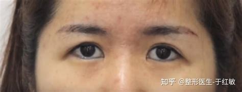 女人眼尾下垂面相|【女人眼尾下垂面相】眼角低垂的女人面相秘密大公開！吉兇禍福。